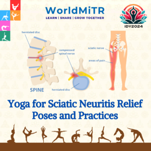 IDY2024: Yoga for Sciatic Neuritis Relief By Sanya Gouthom | Alva’s College of Naturopathy and Yogic Sciences | Nature’s Tranquility